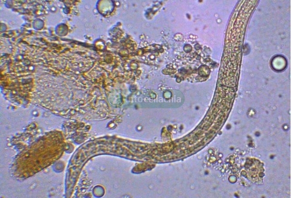 Un'infezione parassitaria attenua i sintomi della celiachia